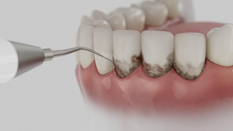 Trusted Teeth Cleaning And Checkup service in Franklin Park, FL - Dentist Open Now